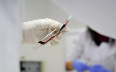 Эпидимиолог Лопушов: &laquo;Развитие вируса Нипах в Татарстане тупиковое&raquo;